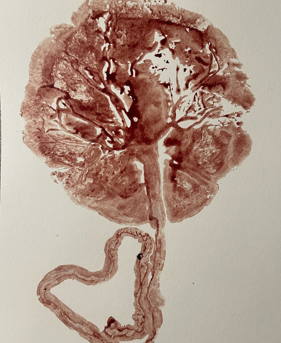 A placenta print — the vessels fan out like the branches of a tree, with the cord curled beneath